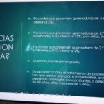 Acelera tu alivio: Guía completa de primeros auxilios para quemaduras menores